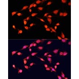Immunofluorescence - Anti-Histone H3 (tri methyl Lys14) Antibody (A16737) - Antibodies.com