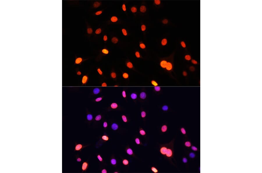 Immunofluorescence - Anti-pan di-methyl Lysine Antibody (A16738) - Antibodies.com