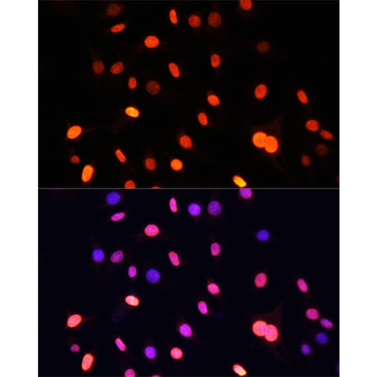 Immunofluorescence - Anti-pan di-methyl Lysine Antibody (A16738) - Antibodies.com