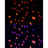 Immunofluorescence - Anti-pan di-methyl Lysine Antibody (A16738) - Antibodies.com