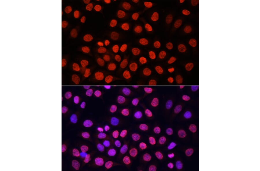 Immunofluorescence - Anti-pan di-methyl Lysine Antibody (A16738) - Antibodies.com