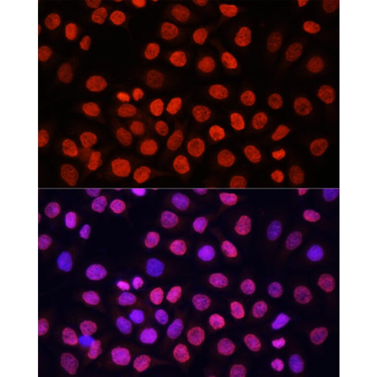 Immunofluorescence - Anti-pan di-methyl Lysine Antibody (A16738) - Antibodies.com
