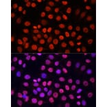 Immunofluorescence - Anti-pan di-methyl Lysine Antibody (A16738) - Antibodies.com
