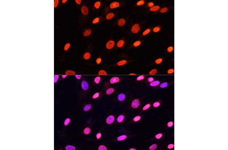 Immunofluorescence - Anti-pan di-methyl Lysine Antibody (A16738) - Antibodies.com