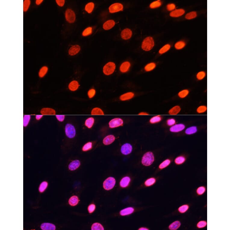 Immunofluorescence - Anti-pan di-methyl Lysine Antibody (A16738) - Antibodies.com