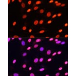 Immunofluorescence - Anti-pan di-methyl Lysine Antibody (A16738) - Antibodies.com