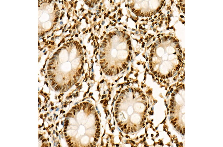 Immunohistochemistry - Anti-Histone H3 (acetyl Lys27) Antibody (A16739) - Antibodies.com