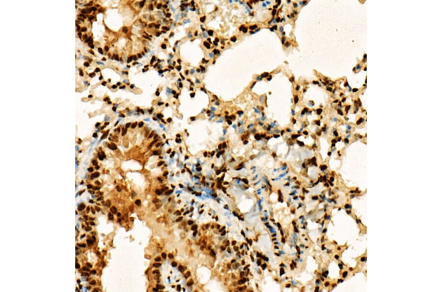 Immunohistochemistry - Anti-Histone H3 (acetyl Lys27) Antibody (A16739) - Antibodies.com