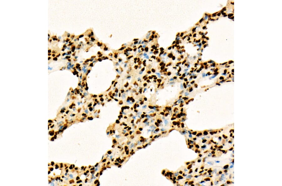 Immunohistochemistry - Anti-Histone H3 (acetyl Lys27) Antibody (A16739) - Antibodies.com