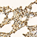 Immunohistochemistry - Anti-Histone H3 (acetyl Lys27) Antibody (A16739) - Antibodies.com