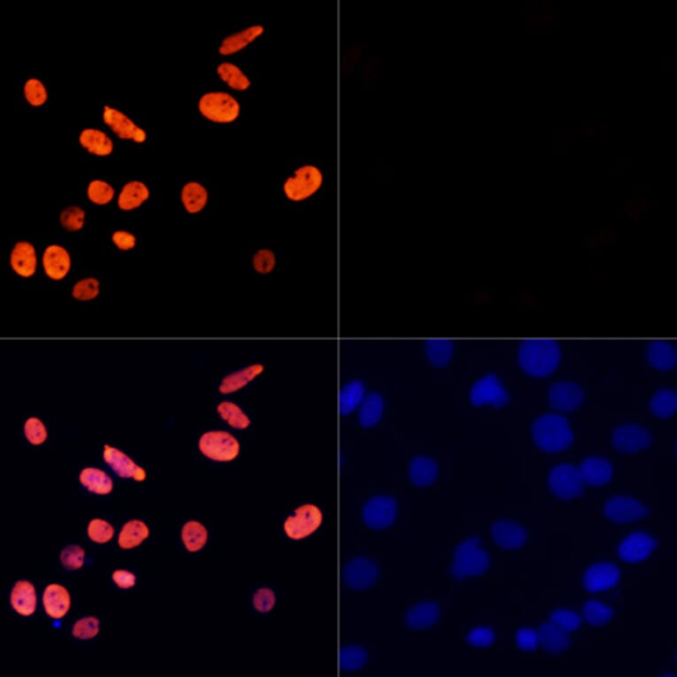 Immunofluorescence - Anti-Histone H3 (acetyl Lys27) Antibody (A16739) - Antibodies.com