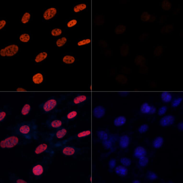 Immunofluorescence - Anti-Histone H3 (acetyl Lys27) Antibody (A16739) - Antibodies.com