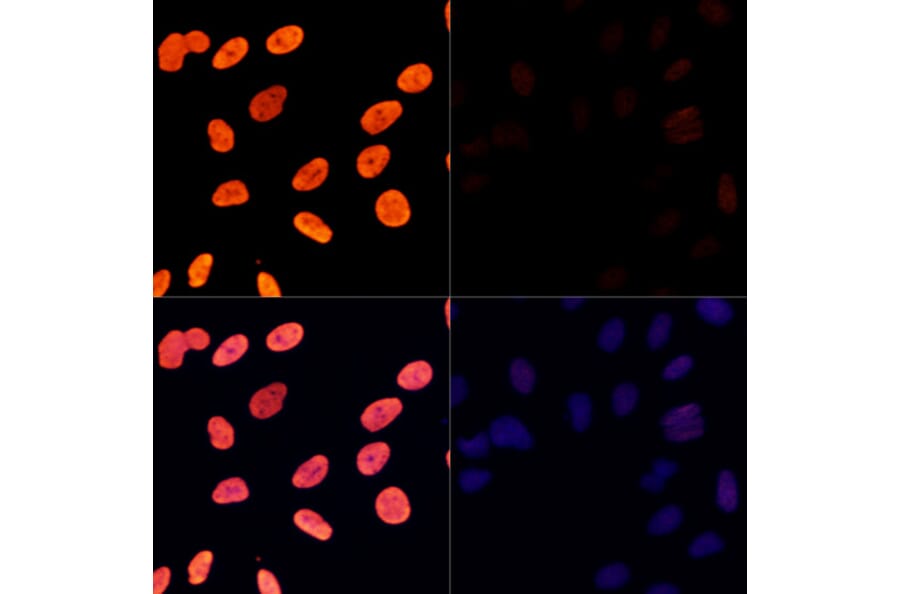 Immunofluorescence - Anti-Histone H3 (acetyl Lys27) Antibody (A16739) - Antibodies.com