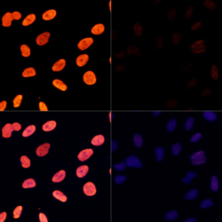 Immunofluorescence - Anti-Histone H3 (acetyl Lys27) Antibody (A16739) - Antibodies.com