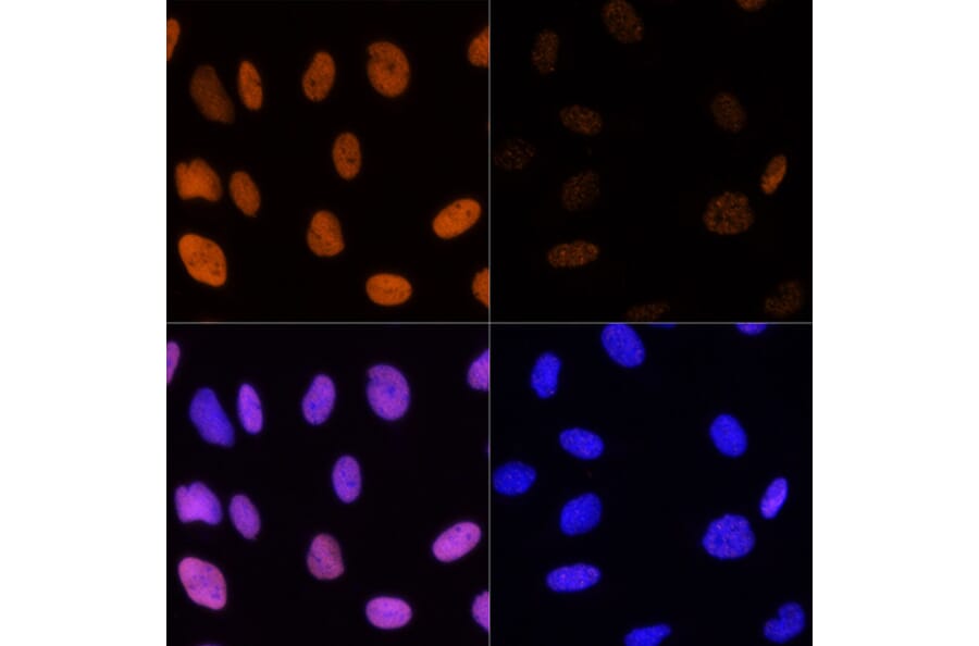Immunofluorescence - Anti-Histone H3 (acetyl Lys14) Antibody (A16740) - Antibodies.com