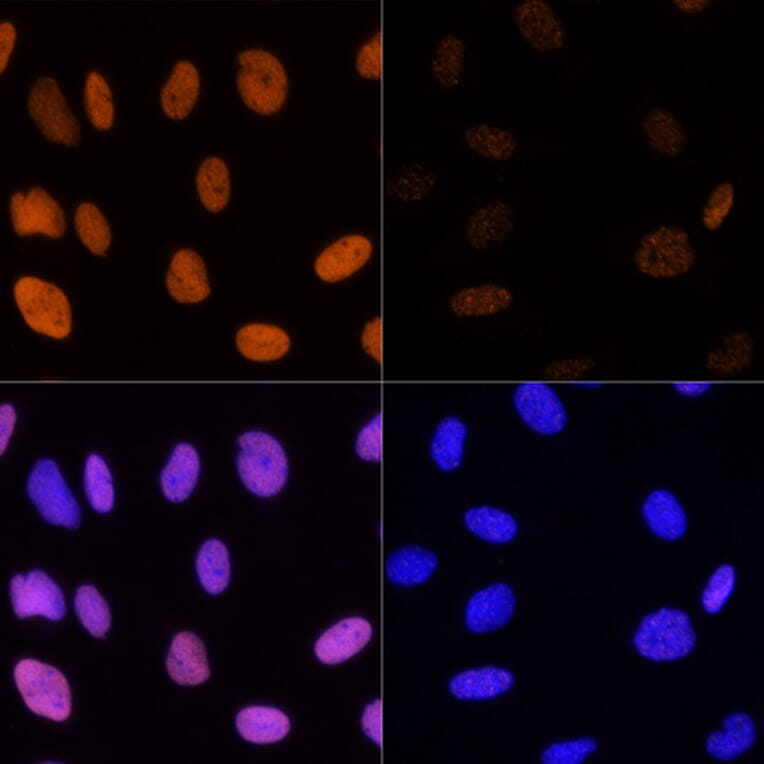 Immunofluorescence - Anti-Histone H3 (acetyl Lys14) Antibody (A16740) - Antibodies.com