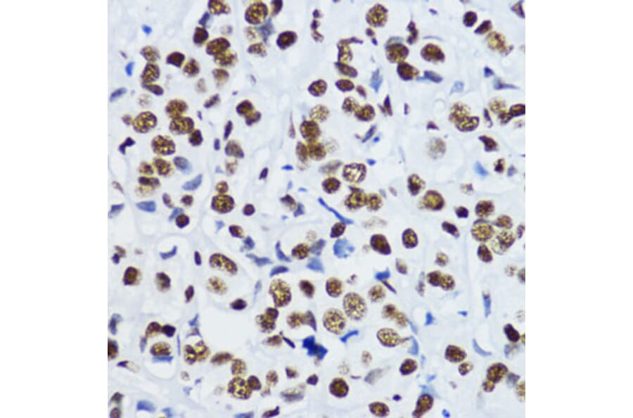 Immunohistochemistry - Anti-Histone H3 (acetyl Lys9) Antibody (A16741) - Antibodies.com