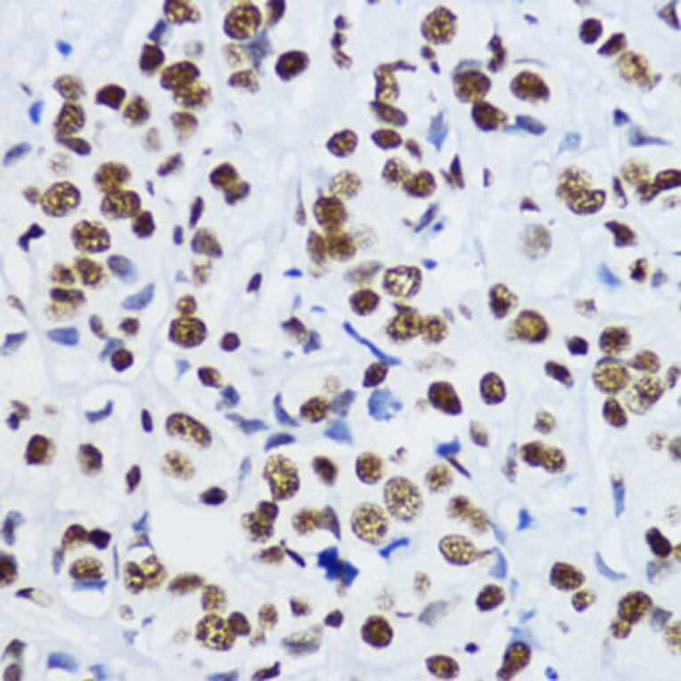 Immunohistochemistry - Anti-Histone H3 (acetyl Lys9) Antibody (A16741) - Antibodies.com