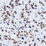 Immunohistochemistry - Anti-Histone H3 (acetyl Lys9) Antibody (A16741) - Antibodies.com