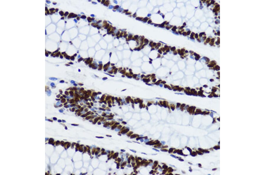 Immunohistochemistry - Anti-Histone H3 (acetyl Lys9) Antibody (A16741) - Antibodies.com