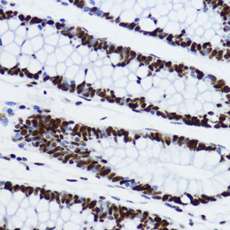 Immunohistochemistry - Anti-Histone H3 (acetyl Lys9) Antibody (A16741) - Antibodies.com
