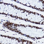 Immunohistochemistry - Anti-Histone H3 (acetyl Lys9) Antibody (A16741) - Antibodies.com