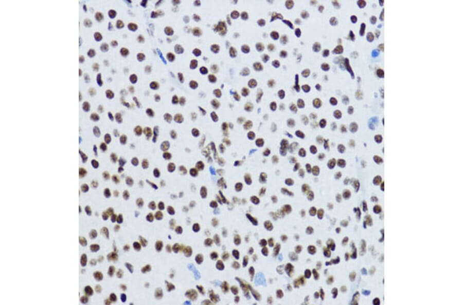 Immunohistochemistry - Anti-Histone H3 (acetyl Lys9) Antibody (A16741) - Antibodies.com