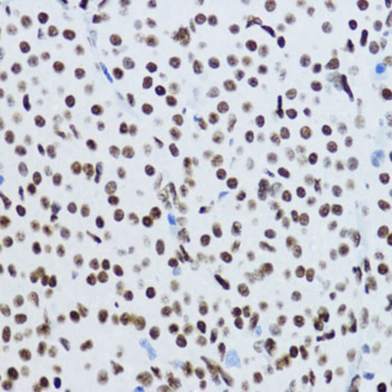 Immunohistochemistry - Anti-Histone H3 (acetyl Lys9) Antibody (A16741) - Antibodies.com
