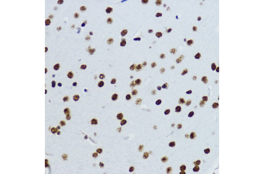 Immunohistochemistry - Anti-Histone H3 (acetyl Lys9) Antibody (A16741) - Antibodies.com