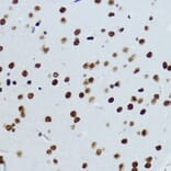 Immunohistochemistry - Anti-Histone H3 (acetyl Lys9) Antibody (A16741) - Antibodies.com