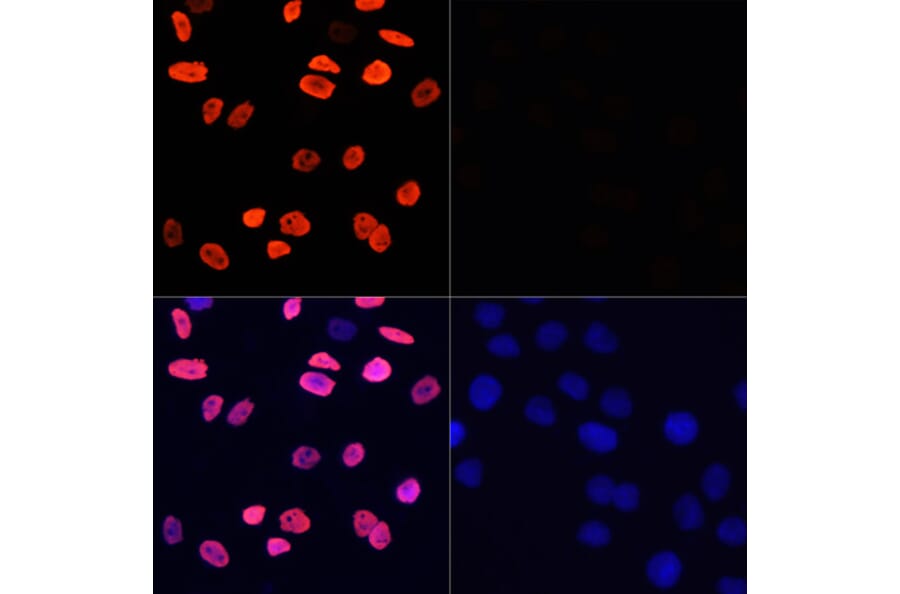 Immunofluorescence - Anti-Histone H3 (acetyl Lys9) Antibody (A16741) - Antibodies.com