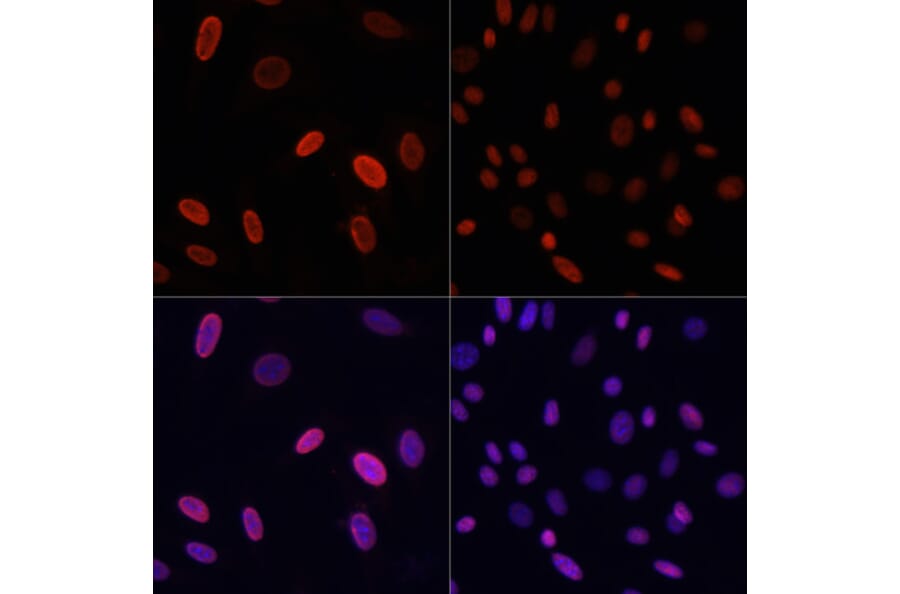 Immunofluorescence - Anti-Histone H3 (acetyl Lys9) Antibody (A16741) - Antibodies.com
