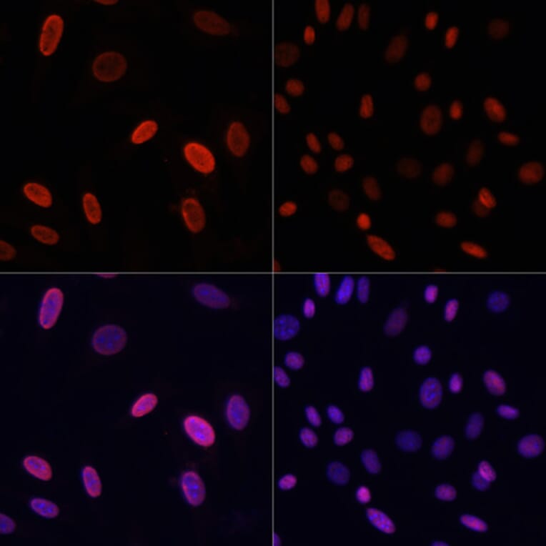 Immunofluorescence - Anti-Histone H3 (acetyl Lys9) Antibody (A16741) - Antibodies.com