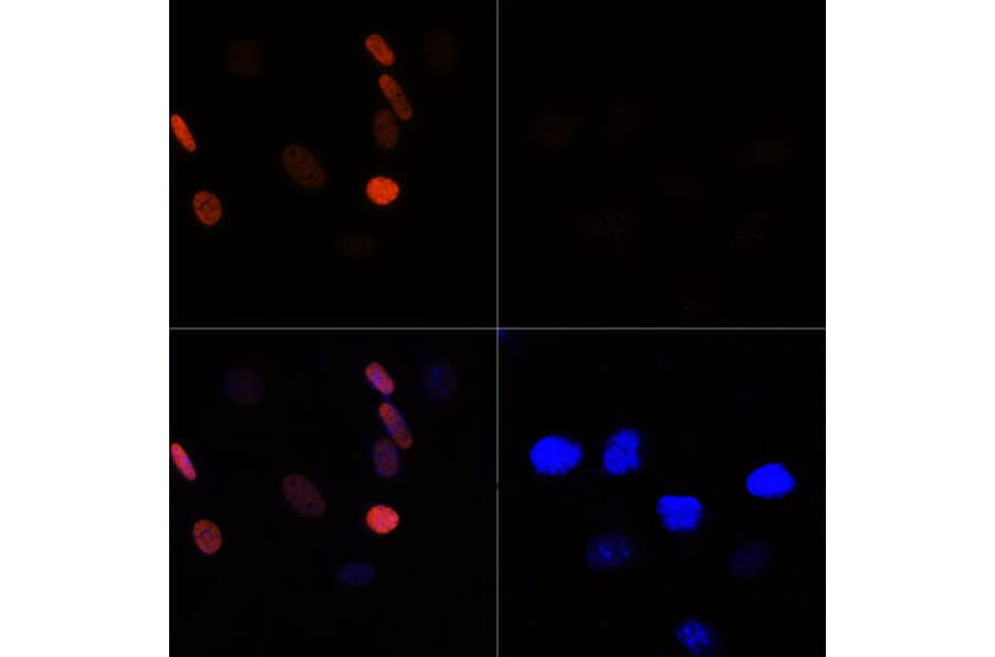 Immunofluorescence - Anti-Histone H3 (acetyl Lys56) Antibody (A16742) - Antibodies.com