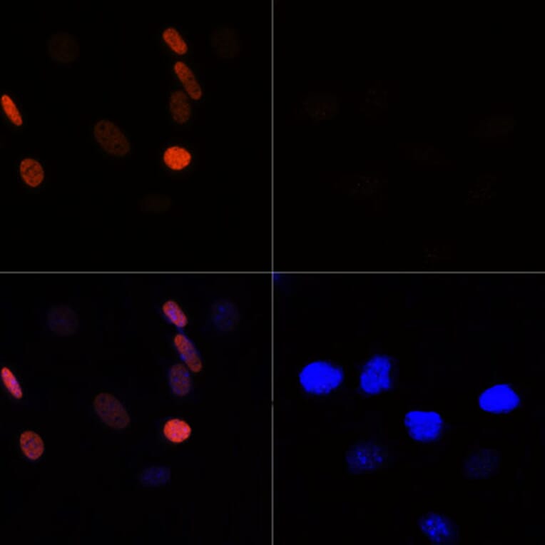 Immunofluorescence - Anti-Histone H3 (acetyl Lys56) Antibody (A16742) - Antibodies.com