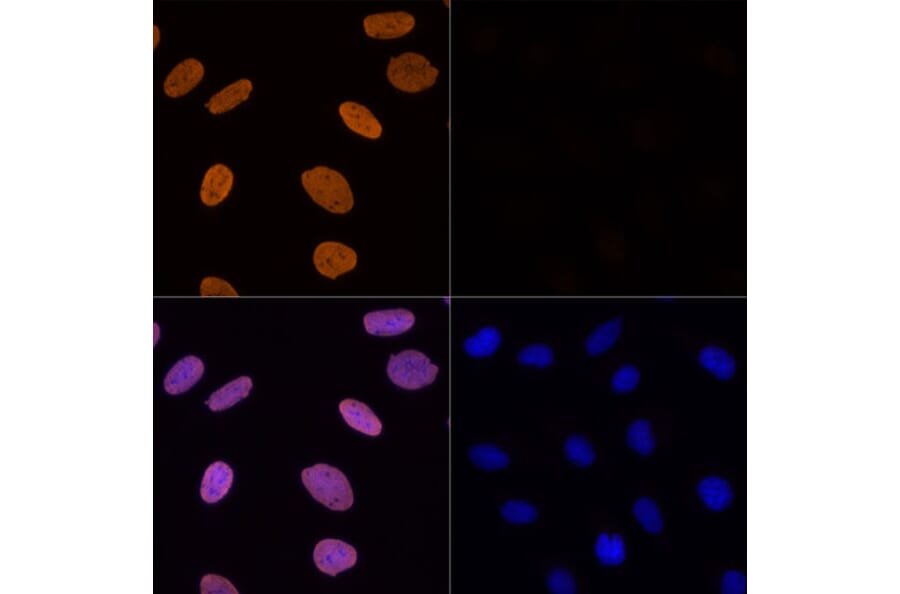 Immunofluorescence - Anti-Histone H3 (acetyl Lys56) Antibody (A16742) - Antibodies.com