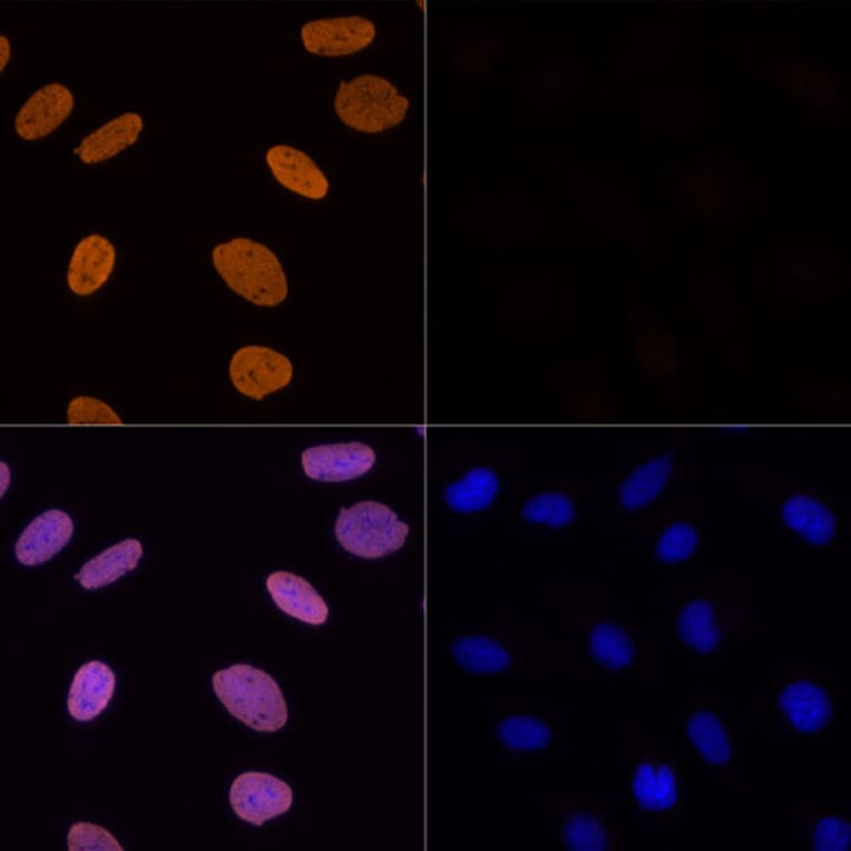 Immunofluorescence - Anti-Histone H3 (acetyl Lys56) Antibody (A16742) - Antibodies.com