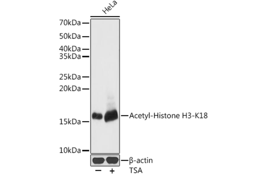 Western Blot - Anti-Histone H3 (acetyl Lys18) Antibody (A16743) - Antibodies.com