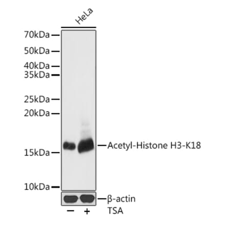 Western Blot - Anti-Histone H3 (acetyl Lys18) Antibody (A16743) - Antibodies.com