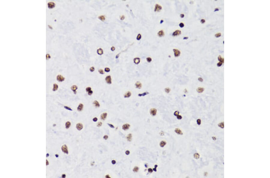 Immunohistochemistry - Anti-Histone H3 (acetyl Lys18) Antibody (A16743) - Antibodies.com