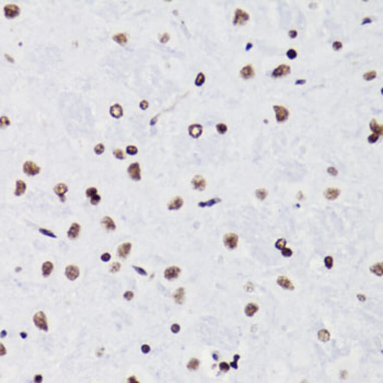 Immunohistochemistry - Anti-Histone H3 (acetyl Lys18) Antibody (A16743) - Antibodies.com