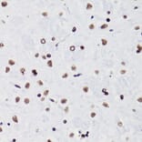 Immunohistochemistry - Anti-Histone H3 (acetyl Lys18) Antibody (A16743) - Antibodies.com