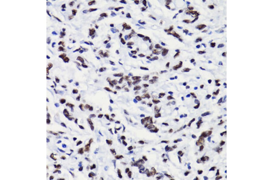Immunohistochemistry - Anti-Histone H3 (acetyl Lys18) Antibody (A16743) - Antibodies.com