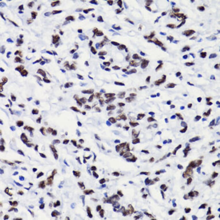 Immunohistochemistry - Anti-Histone H3 (acetyl Lys18) Antibody (A16743) - Antibodies.com