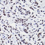 Immunohistochemistry - Anti-Histone H3 (acetyl Lys18) Antibody (A16743) - Antibodies.com