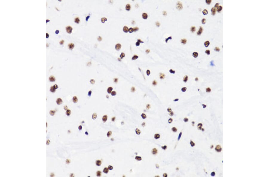 Immunohistochemistry - Anti-Histone H3 (acetyl Lys18) Antibody (A16743) - Antibodies.com