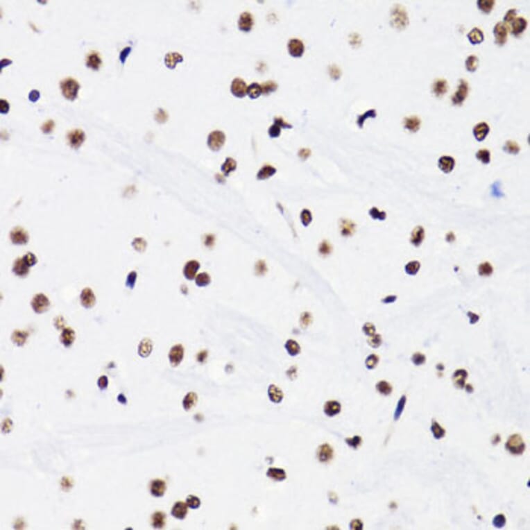 Immunohistochemistry - Anti-Histone H3 (acetyl Lys18) Antibody (A16743) - Antibodies.com