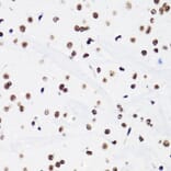 Immunohistochemistry - Anti-Histone H3 (acetyl Lys18) Antibody (A16743) - Antibodies.com