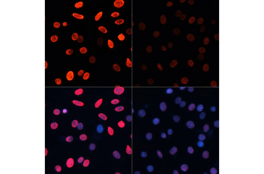 Immunofluorescence - Anti-Histone H3 (acetyl Lys18) Antibody (A16743) - Antibodies.com
