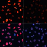 Immunofluorescence - Anti-Histone H3 (acetyl Lys18) Antibody (A16743) - Antibodies.com